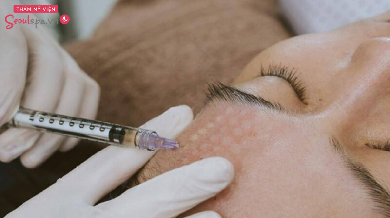 Chăm sóc da sau tiêm meso để đảm bảo vết thương hồi phục nhanh, hạn chế tối đa viêm nhiễm