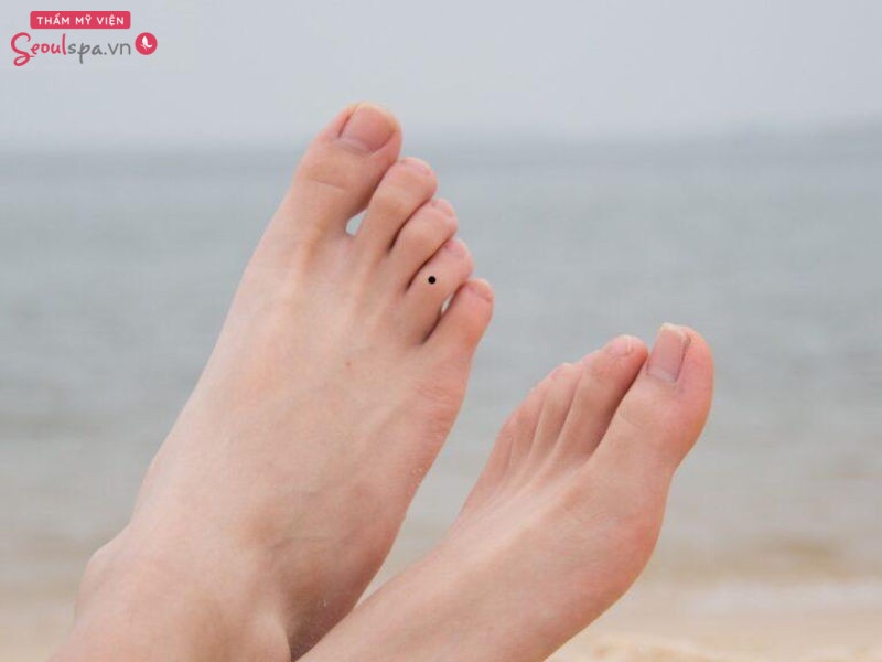 Người sở hữu nốt ruồi ở ngón chân áp út thường có sức khỏe không tốt