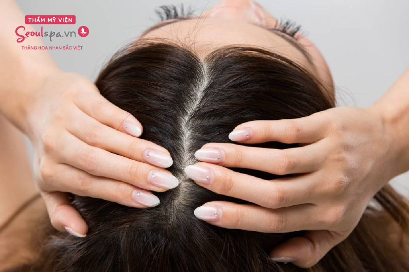 Hội chứng nghiện giật tóc gây ra tình trạng hói và khó mọc lại lông mi
