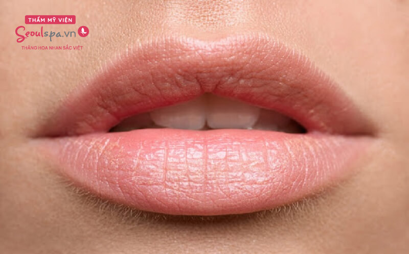 Sau Lúc khử rạm song môi sẽ có được màu sắc hồng nhẹ dịu, tự động nhiên
