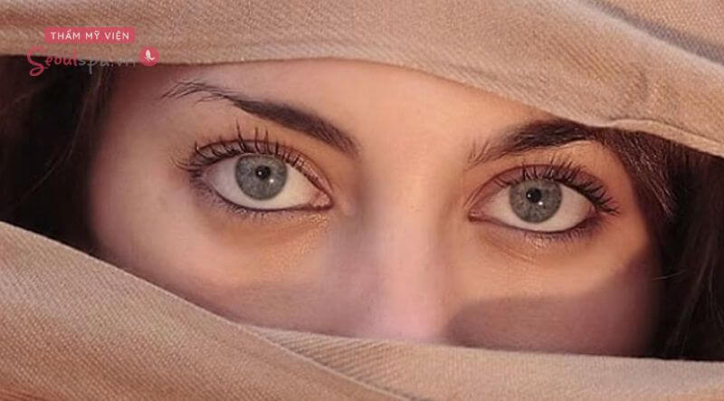 Người với đôi mắt tam bạch thông thường được phân biệt vày đôi mắt với 3 khoảng tầm trắng