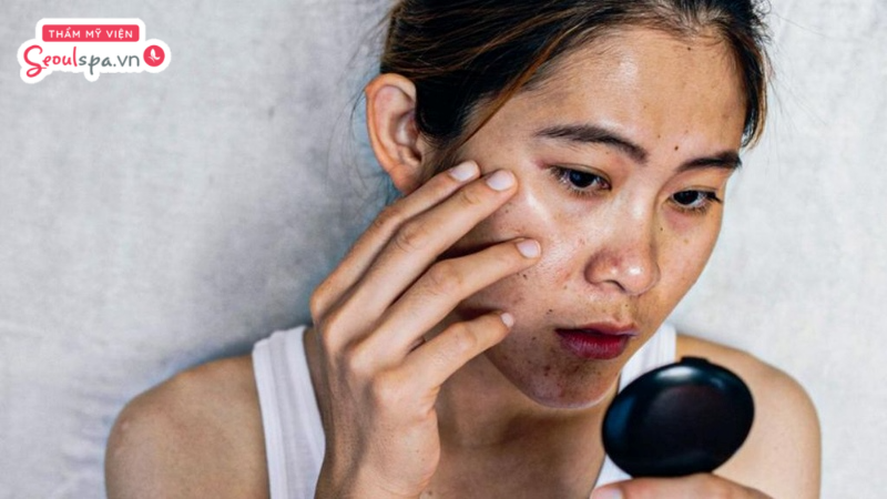 Người có làn da thâm sạm, xỉn màu và nhiễm chì có thể thực hiện thải độc da thường xuyên để làm sạch da từ bên trong