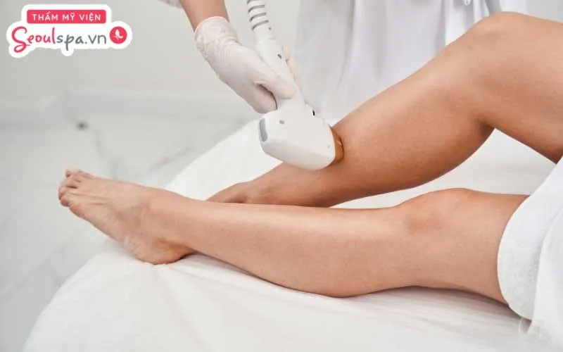 Thực hiện triệt lông tại spa với công nghệ hiện đại được cho là cách dọn lông nhanh chóng và duy trì hiệu quả lâu dài